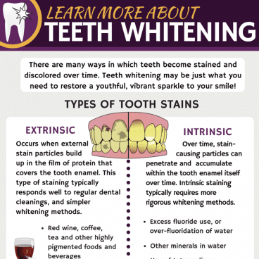 Learn more about Teeth Whitening.